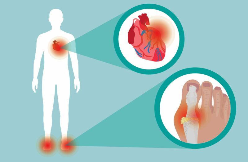 cartoon shows an image of a person with pain in the heart and the feet. There is a zoomed-in image of the heart and a zoomed-in image of gout in the toe joints