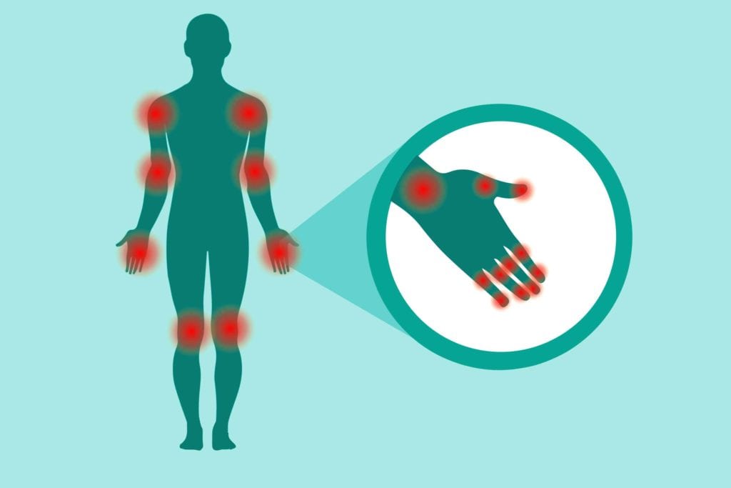 Tender Joint Count for Arthritis