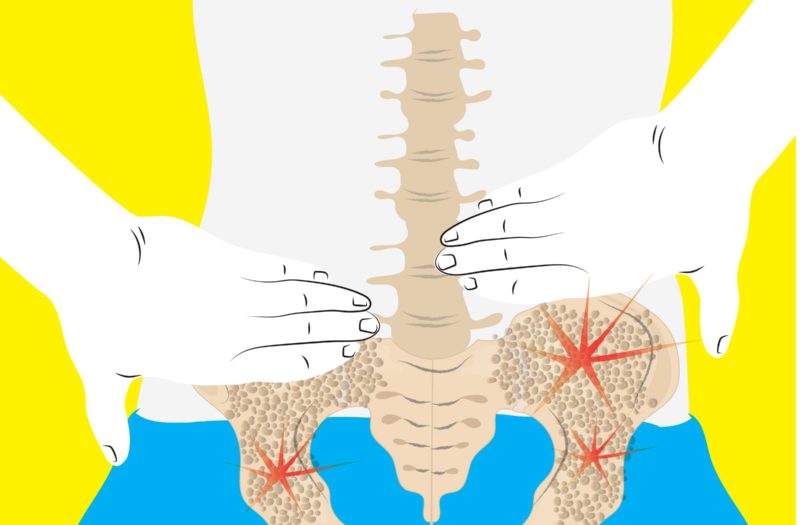 Cartoon shows the spine and hips through the lower back. The hips have red stars indicating back pain