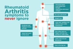 Rheumatoid Arthritis Symptoms to never ignore