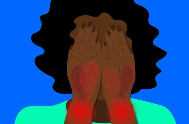 An illustration of a woman of color covering her face with her hands. Her hands are red and scabby due to psoriatic arthritis.