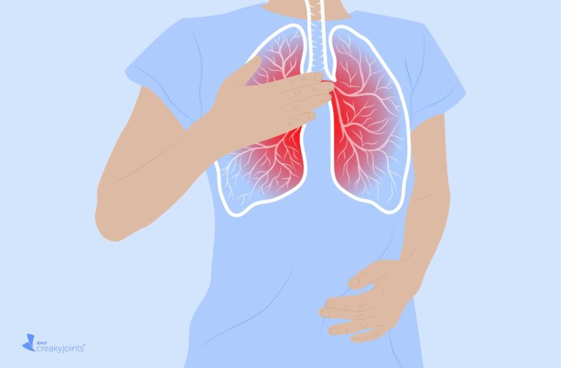 Pneumonia Lungs