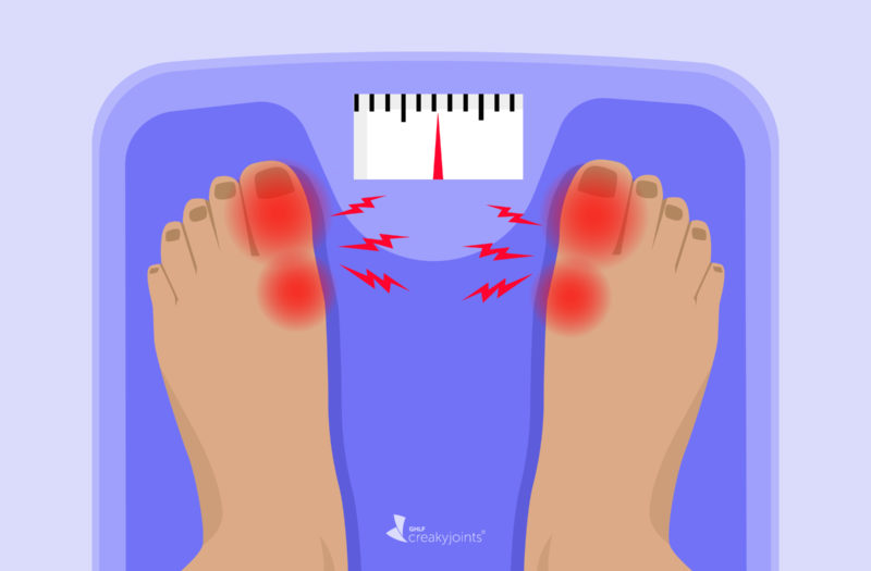 An illustration of feet suffering a gout flare up standing on a scale.
